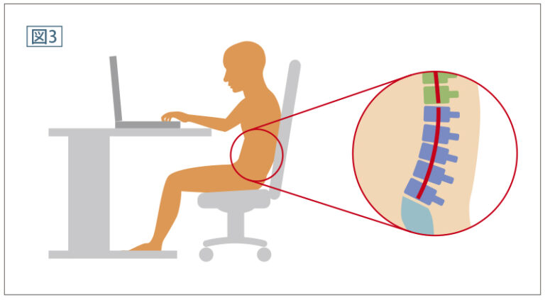 上半身の体重が腰に かかって、腰椎を支える筋肉に負担がかかることになります